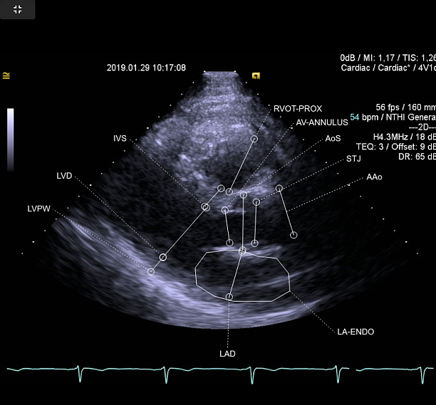 Photo 1 - Deep Learning for automated heart ultrasound examination